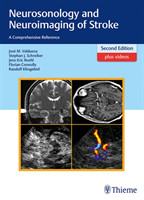 Neurosonology and Neuroimaging of Stroke: A Comprehensive Reference, 2nd Ed.