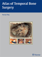 Atlas of Temporal Bone Surgery