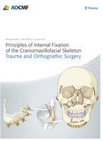 Principles of Internal Fixation of Craniomaxillofacial Skeleton