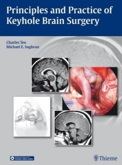 Principles and Practice of Keyhole Brain Surgery