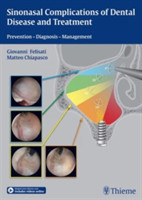 Sinonasal Complications of Dental Disease and Treatment