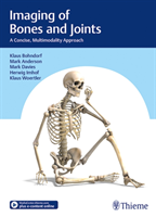 Imaging of Bones and Joints