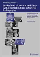 Borderlands of Pathological Findings in Skeletal Radiography