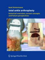 Total Ankle Arthroplasty