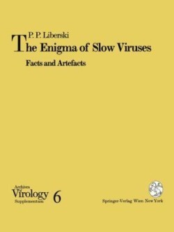 Enigma of Slow Viruses