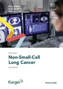 Fast Facts: Non-Small-Cell Lung Cancer