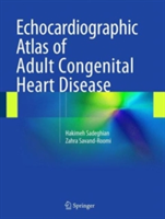 Echocardiographic Atlas of Adult Congenital Heart Disease