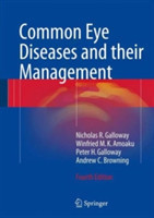 Common Eye Diseases and their Management   *