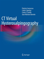 CT Virtual Hysterosalpingography