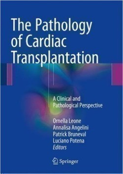 The Pathology of Cardiac Transplantation A clinical and pathological perspective