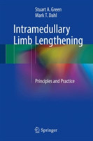 Intramedullary Limb Lengthening*