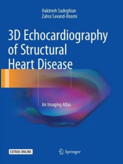 3D Echocardiography of Structural Heart Disease