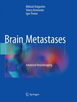 Brain Metastases