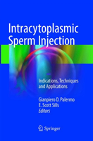 Intracytoplasmic Sperm Injection