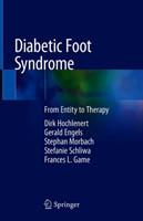 Diabetic Foot Syndrome