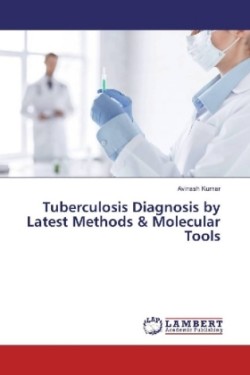 Tuberculosis Diagnosis by Latest Methods & Molecular Tools