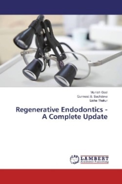 Regenerative Endodontics - A Complete Update