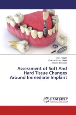 Assessment of Soft And Hard Tissue Changes Around Immediate Implant