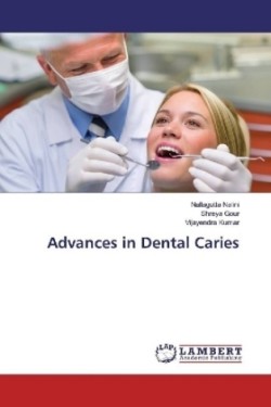 Advances in Dental Caries