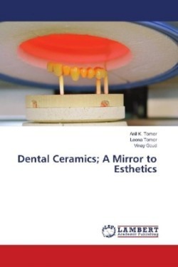 Dental Ceramics; A Mirror to Esthetics