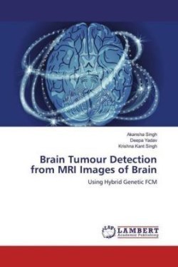 Brain Tumour Detection from MRI Images of Brain