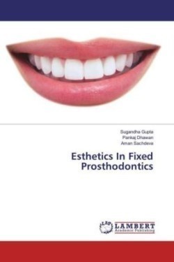 Esthetics In Fixed Prosthodontics