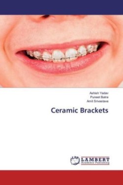 Ceramic Brackets