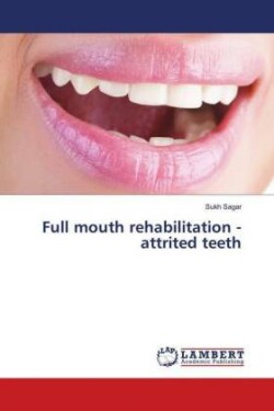 Full mouth rehabilitation - attrited teeth