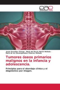 Tumores óseos primarios malignos en la infancia y adolescencia.