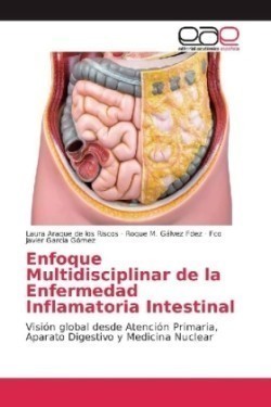 Enfoque Multidisciplinar de la Enfermedad Inflamatoria Intestinal