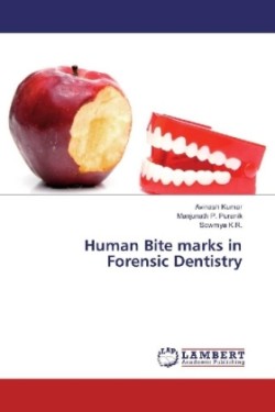 Human Bite marks in Forensic Dentistry