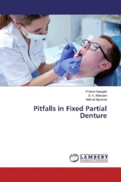 Pitfalls in Fixed Partial Denture