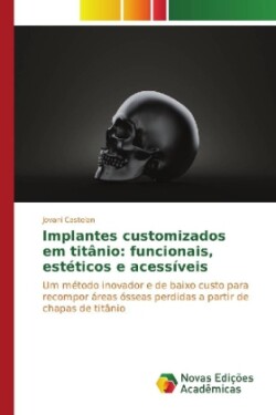 Implantes customizados em titânio: funcionais, estéticos e acessíveis