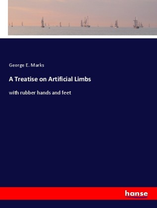 Treatise on Artificial Limbs