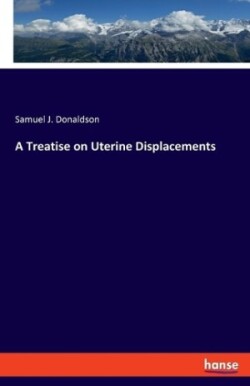 Treatise on Uterine Displacements