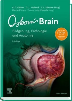 Osborn's Brain