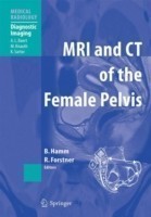 Mri and Ct of Female Pelvis