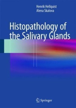 Histopathology of Salivary Glands