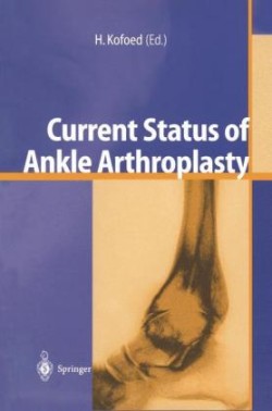 Current Status of Ankle Arthroplasty