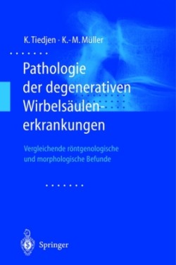 Pathologie der degenerativen Wirbelsäulenerkrankungen