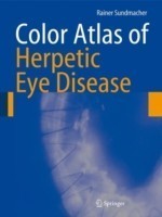Color Atlas of Herpetic Eye Disease