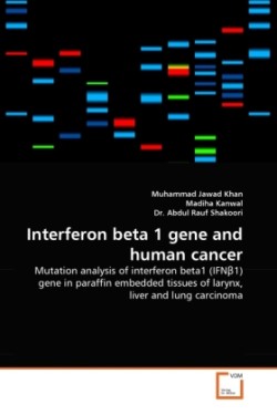 Interferon beta 1 gene and human cancer