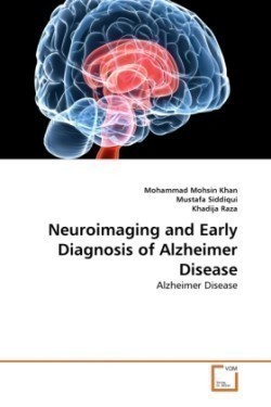 Neuroimaging and Early Diagnosis of Alzheimer Disease