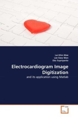 Electrocardiogram Image Digitization