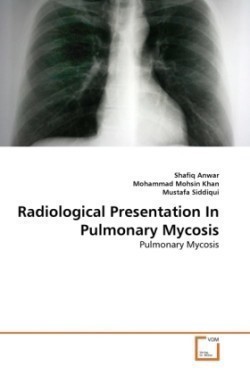 Radiological Presentation In Pulmonary Mycosis