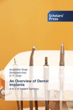 Overview of Dental Implants