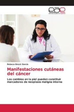 Manifestaciones cutáneas del cáncer