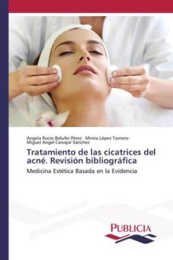 Tratamiento de las cicatrices del acné. Revisión bibliográfica