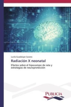 Radiación X neonatal