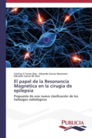 papel de la Resonancia Magnética en la cirugía de epilepsia